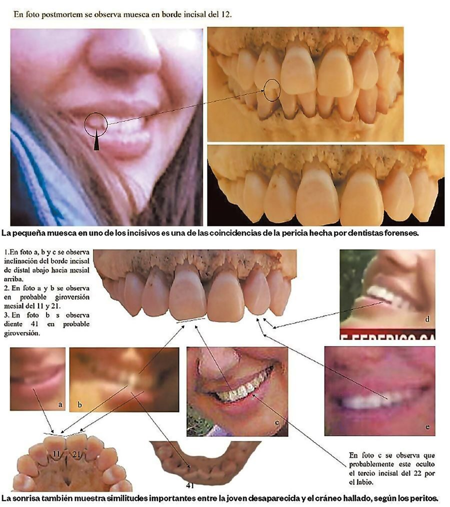 Maria Cash dientes