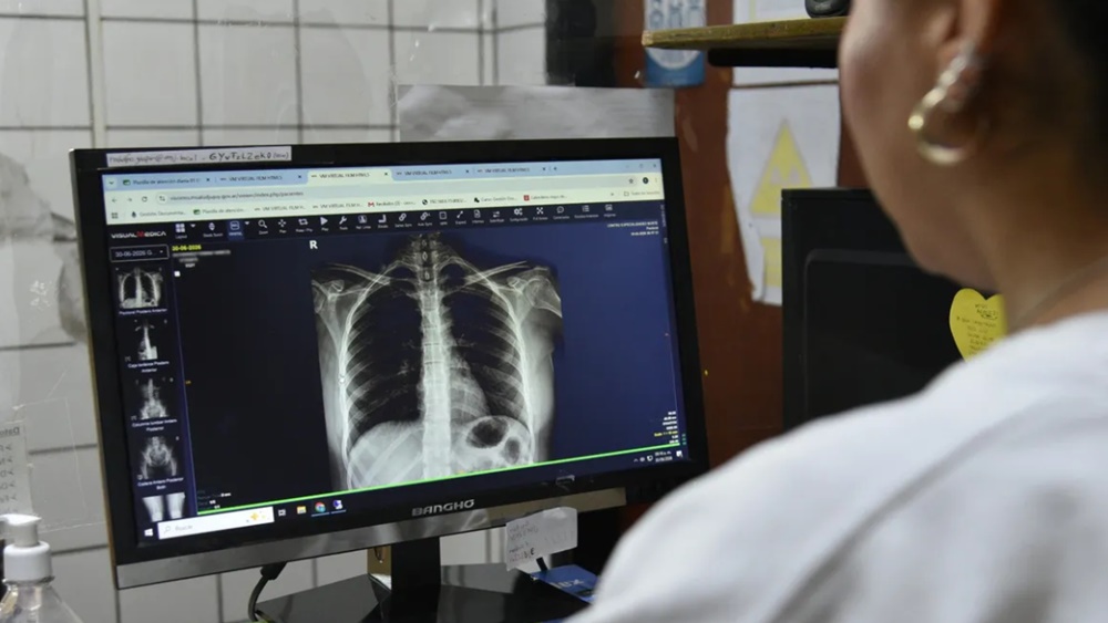 Jujuy digitalizó los estudios por imágenes en toda la red pública de salud